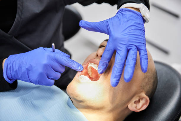 Best Emergency Treatment for Dental Infections or Abscesses in Dos Palos, CA