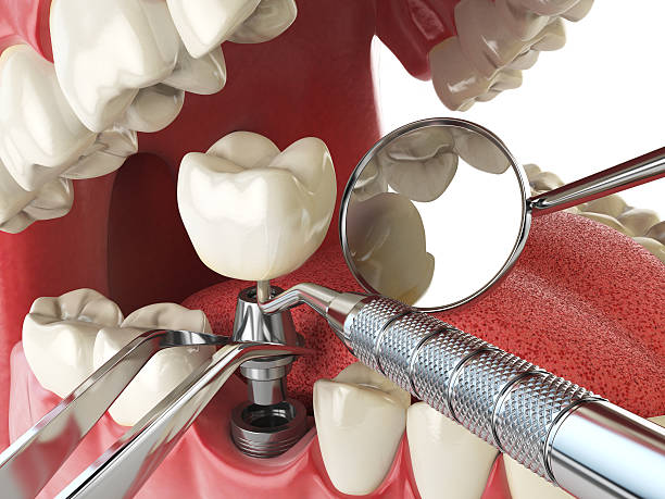 Best Emergency Gum Treatment in Dos Palos, CA